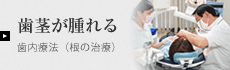 歯内療法